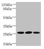 Plet1 Antibody in Western Blot (WB)