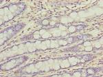 FAM222B Antibody in Immunohistochemistry (Paraffin) (IHC (P))