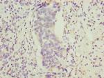 FAM222B Polyclonal Antibody