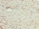 PPIL4 Polyclonal Antibody