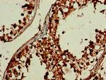 DEPDC1B Antibody in Immunohistochemistry (Paraffin) (IHC (P))