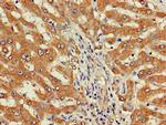 DEPDC1B Antibody in Immunohistochemistry (Paraffin) (IHC (P))
