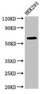 DEPDC1B Antibody in Western Blot (WB)