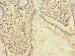 FAM86A Polyclonal Antibody