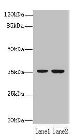 FAM86A Antibody in Western Blot (WB)