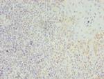 LILRA2 Polyclonal Antibody