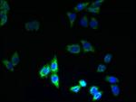 PQLC3 Polyclonal Antibody