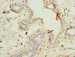 CEP76 Antibody in Immunohistochemistry (Paraffin) (IHC (P))