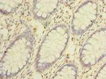 CEP76 Antibody in Immunohistochemistry (Paraffin) (IHC (P))