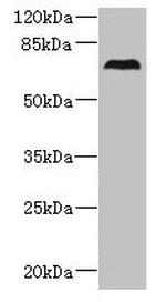 CEP76 Antibody in Western Blot (WB)
