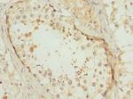 POC1B Antibody in Immunohistochemistry (Paraffin) (IHC (P))