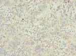 POC1B Polyclonal Antibody