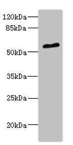 POC1B Antibody in Western Blot (WB)