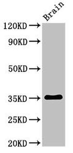 METRNL Polyclonal Antibody