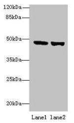 FAM46B Polyclonal Antibody