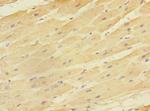 EAF2 Polyclonal Antibody