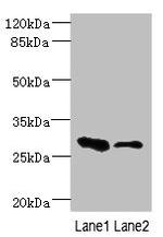 EAF2 Antibody in Western Blot (WB)