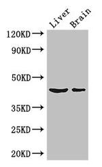 METTL2 Polyclonal Antibody