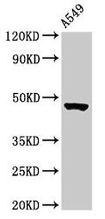 CT112 Antibody in Western Blot (WB)