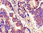 AKAP9 Antibody in Immunohistochemistry (Paraffin) (IHC (P))