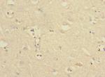 PTPN18 Polyclonal Antibody