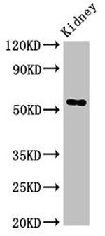 FUCA1 Polyclonal Antibody