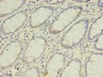 DPH2 Polyclonal Antibody