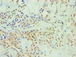 SPIN2 Antibody in Immunohistochemistry (Paraffin) (IHC (P))