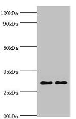 SPIN2 Antibody in Western Blot (WB)