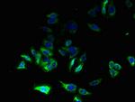 C17orf62 Polyclonal Antibody