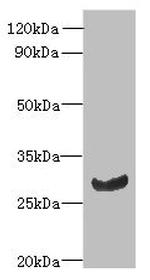 CK068 Antibody in Western Blot (WB)