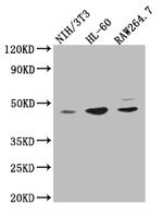 ZDHHC6 Polyclonal Antibody