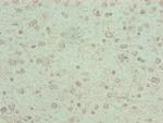 KCNK13 Antibody in Immunohistochemistry (Paraffin) (IHC (P))