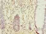 CCDC106 Polyclonal Antibody
