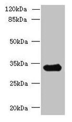 CCDC106 Antibody in Western Blot (WB)
