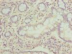 PPIL3 Polyclonal Antibody