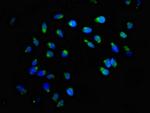 ACBD3 Polyclonal Antibody