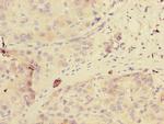 GDPD2 Antibody in Immunohistochemistry (Paraffin) (IHC (P))