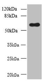 GDPD2 Antibody in Western Blot (WB)
