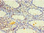 CYP4F12 Polyclonal Antibody
