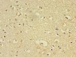 FLRT1 Antibody in Immunohistochemistry (Paraffin) (IHC (P))