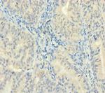ZMAT5 Polyclonal Antibody