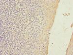 SLC23A2 Polyclonal Antibody