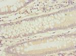 Tug Antibody in Immunohistochemistry (Paraffin) (IHC (P))
