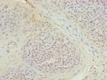 TUBB1 Antibody in Immunohistochemistry (Paraffin) (IHC (P))