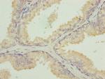 TUBB1 Antibody in Immunohistochemistry (Paraffin) (IHC (P))
