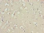TUBB1 Antibody in Immunohistochemistry (Paraffin) (IHC (P))