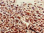 ST6GALNAC1 Antibody in Immunohistochemistry (Paraffin) (IHC (P))