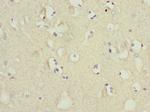 MTCH1 Polyclonal Antibody