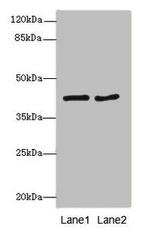 MTCH1 Antibody in Western Blot (WB)